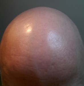 George's egghead